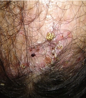 Jundishapur J Health Sci